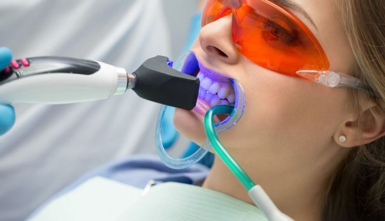 teeth whitening procedure